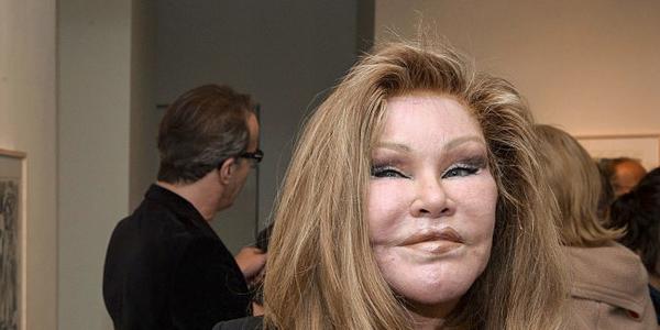 Jocelyn Wildenstein